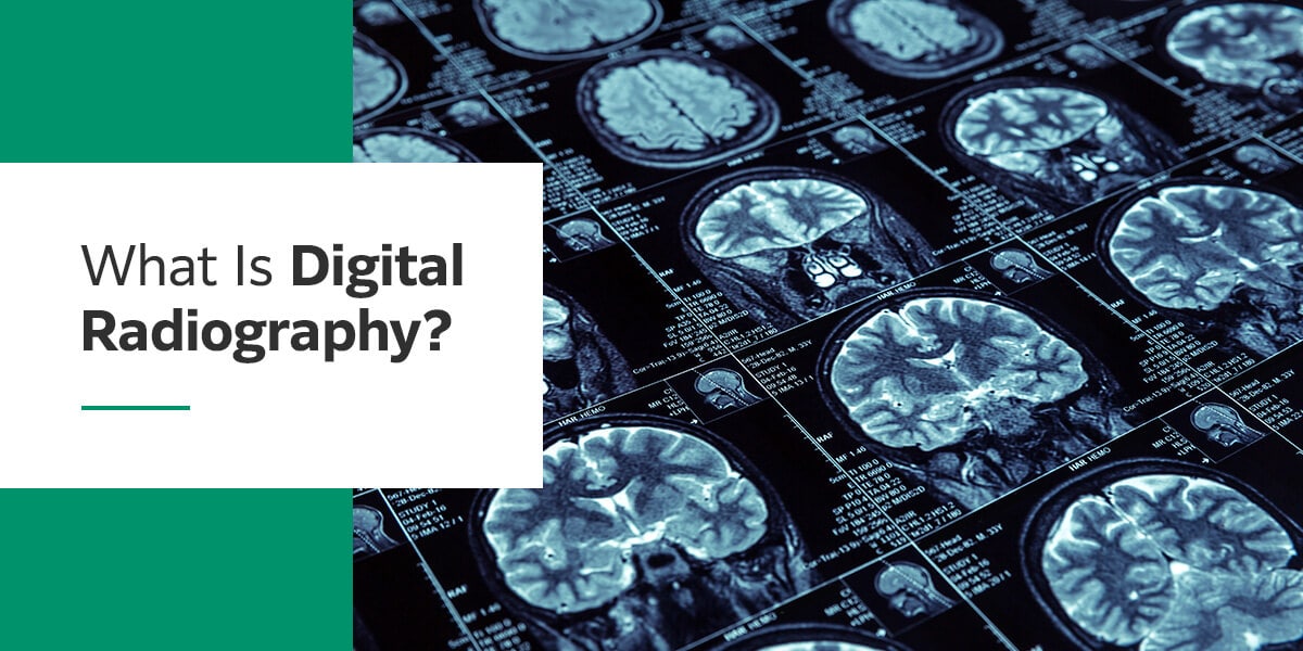 What is digital radiography?