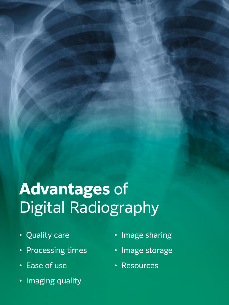 Advantages of digital radiography