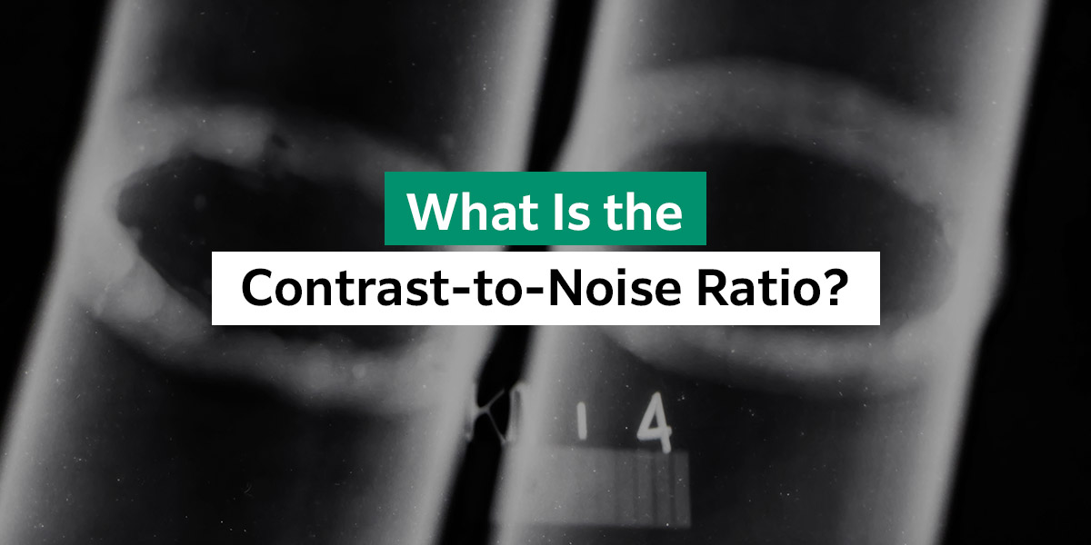 What is the Contrast-to-Noise Ratio?